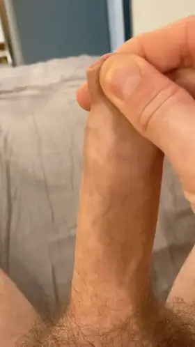 Sperm in the Foreskin