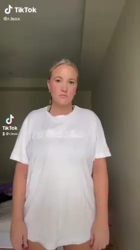 What A Fantastic Pair Of Melons 🍈