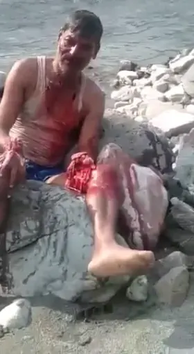 Fishing with explosives gone wrong. Link in comments.